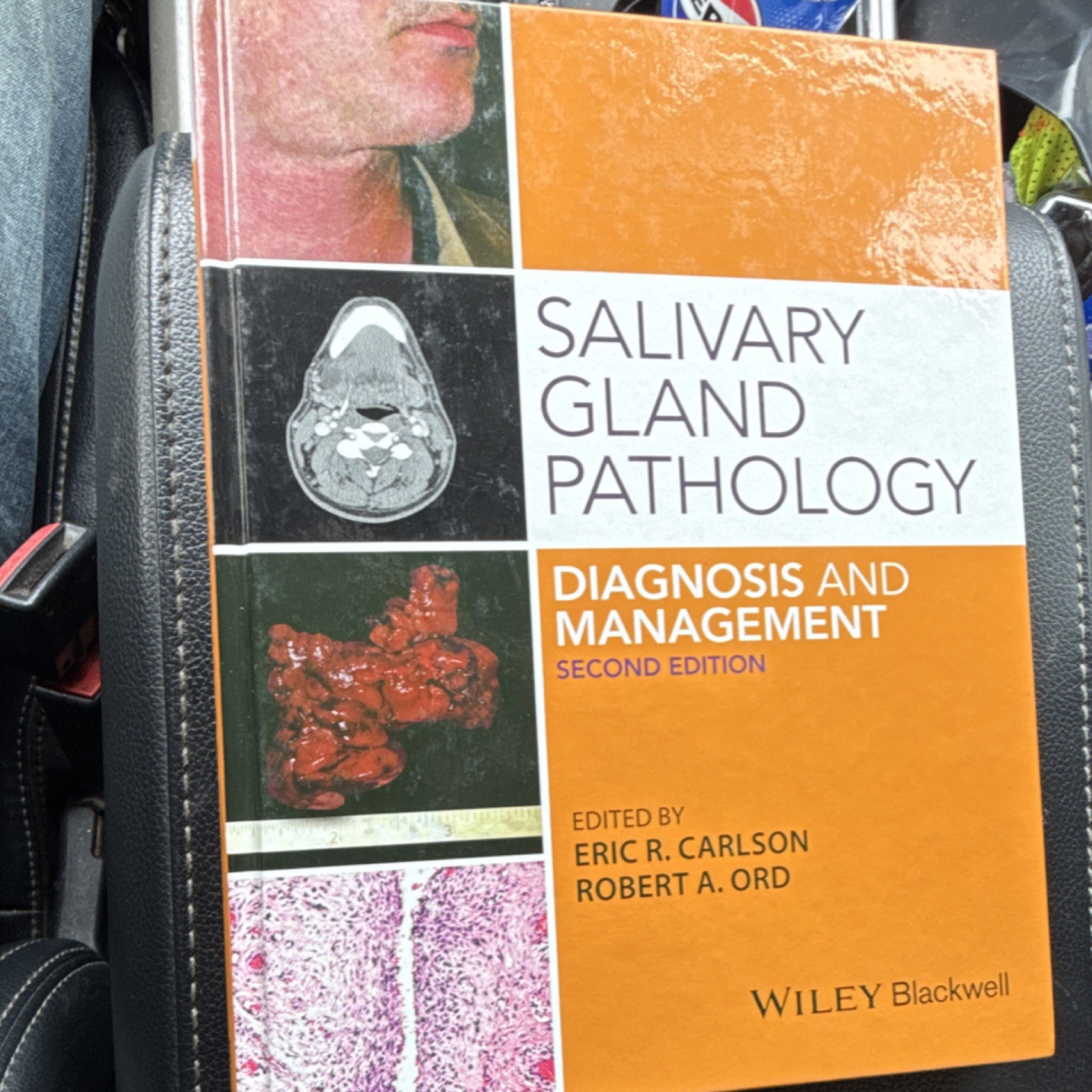 Wiley Salivary Gland Pathology 2nd Ed Hardcover Carlson Ord