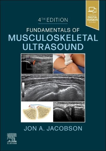 Fundamentals of Musculoskeletal Ultrasound by Jon A. Jacobson – 9780323791502