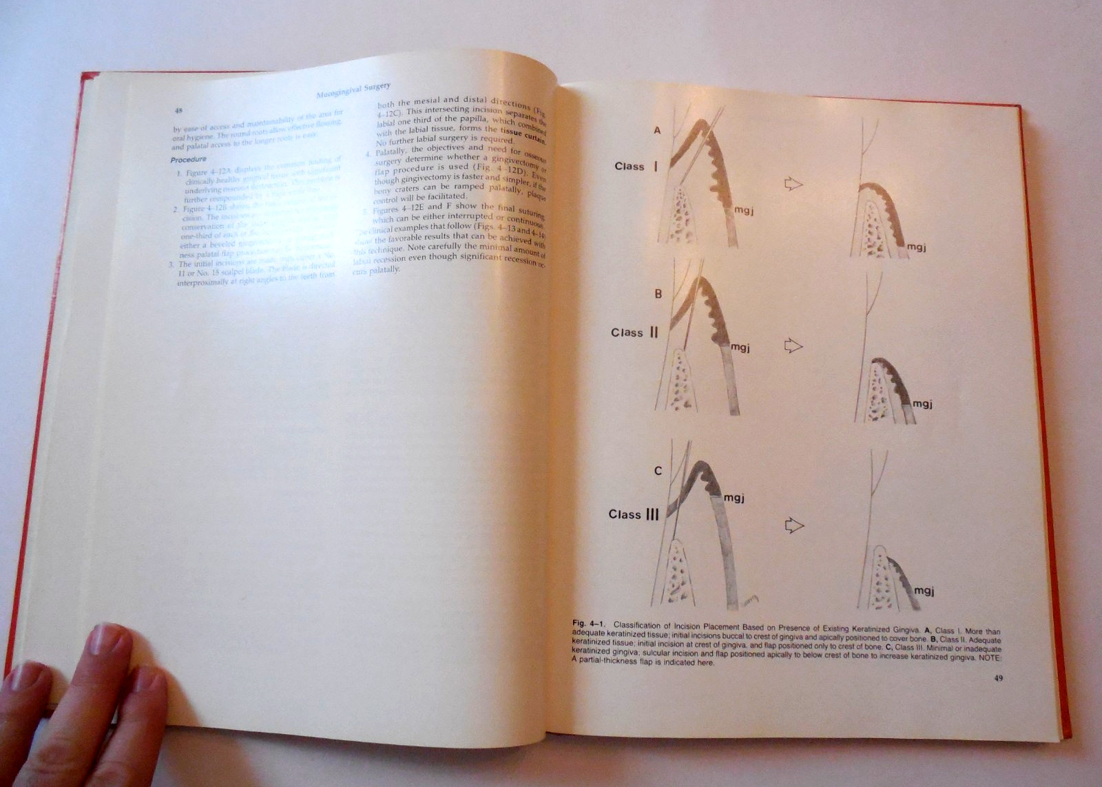 Atlas of Periodontal Surgery by Edward S. Cohen 1988 Hardcover Dentistry