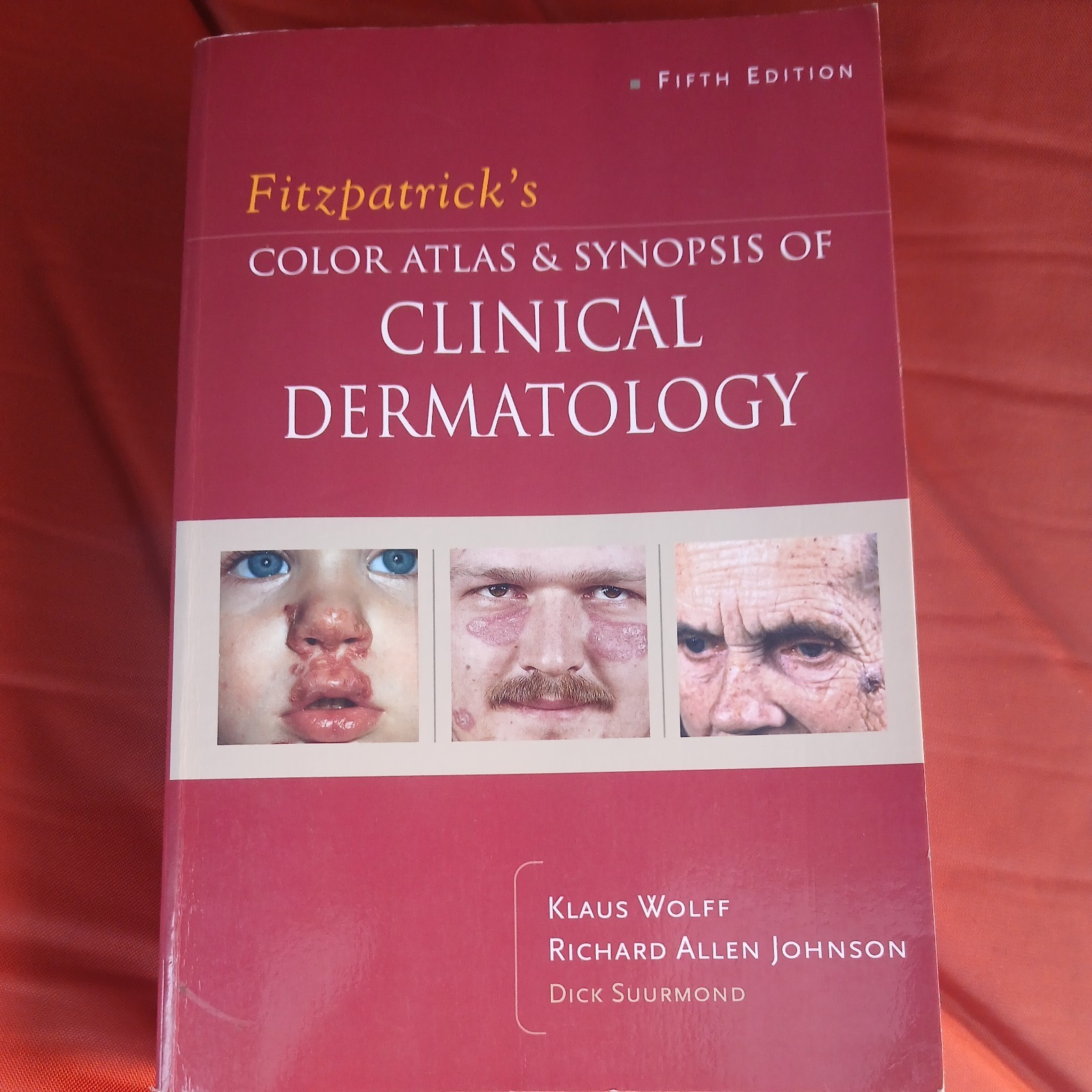 Fitzpatrick’s Color Atlas and Synopsis of Clinical Dermatology