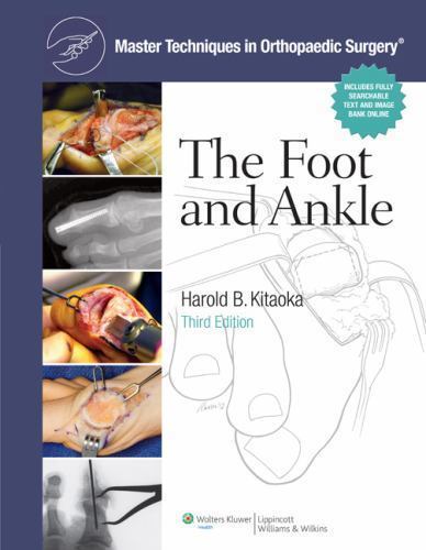 Master Techniques in Orthopaedic Surgery: The Foot and Ankle, Kitaoka MD, Harold
