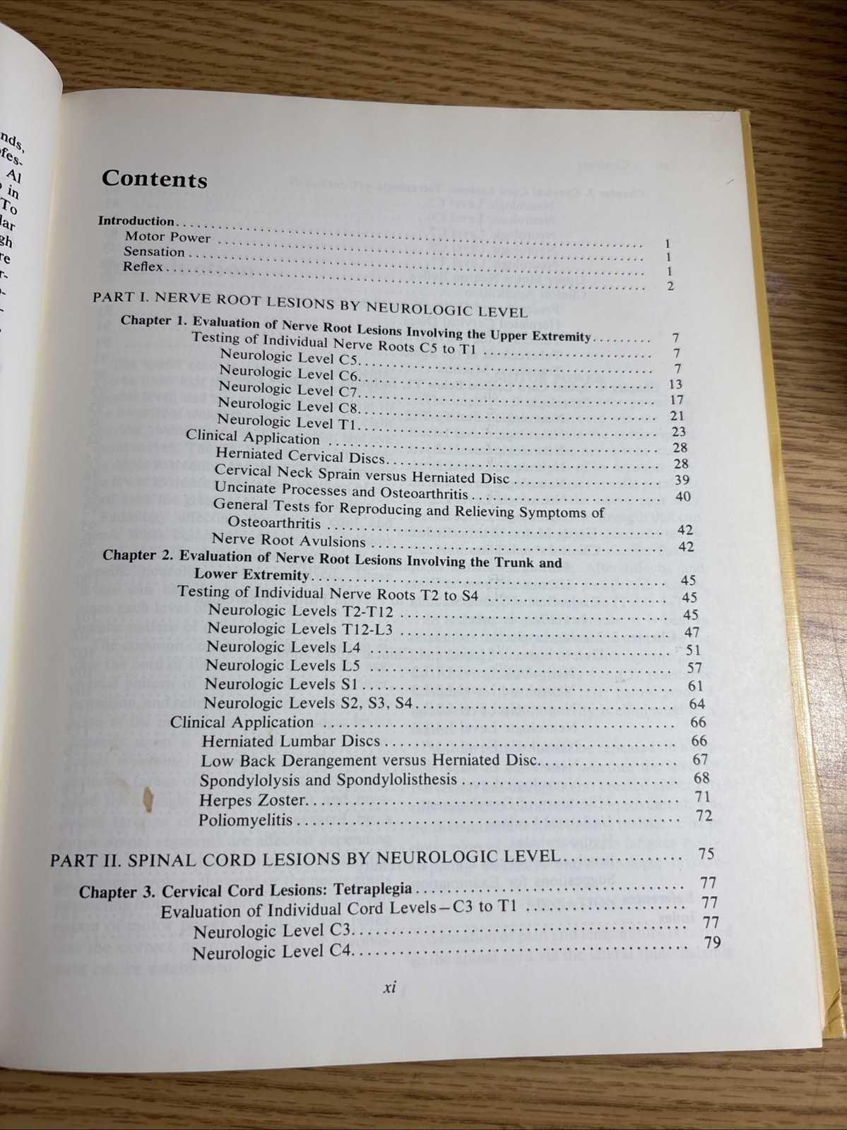 Orthopaedic Neurology : A Diagnostic Guide to Neurologic Levels Hardcover 1977