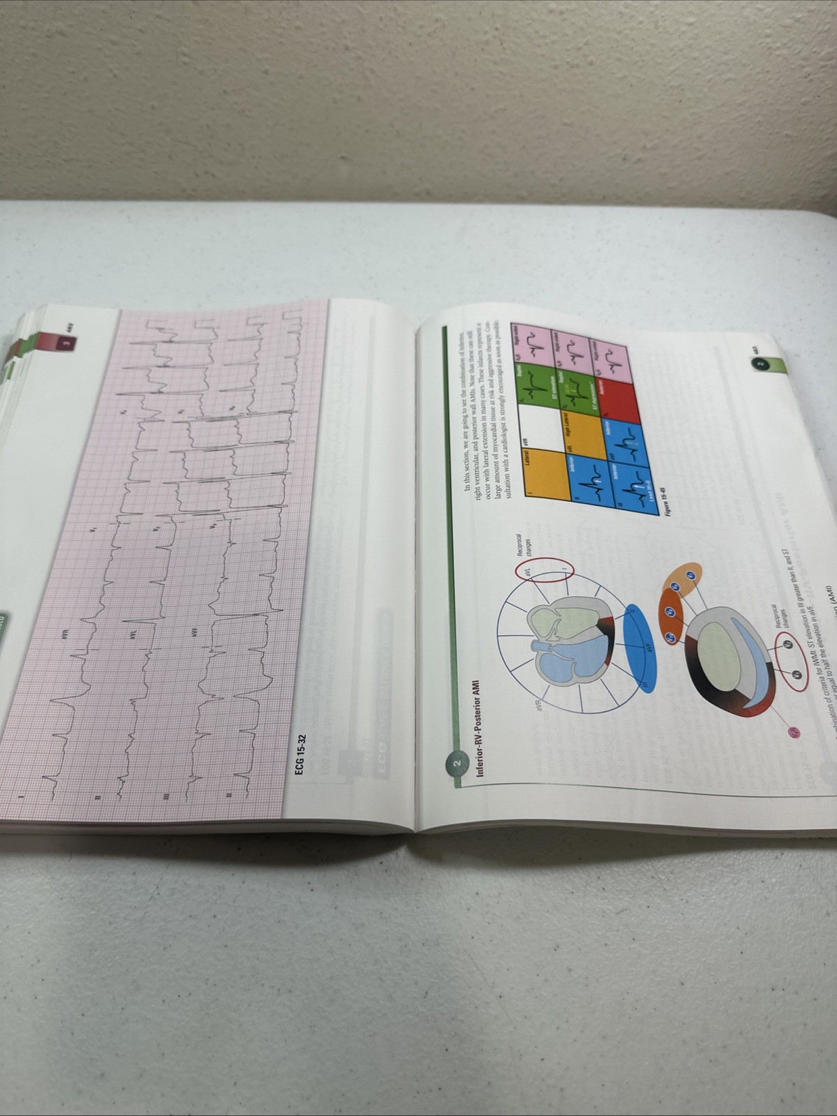 12-Lead ECG The Art Of Interpretation 2nd Edition Tomas B Garcia 2015 Paperback