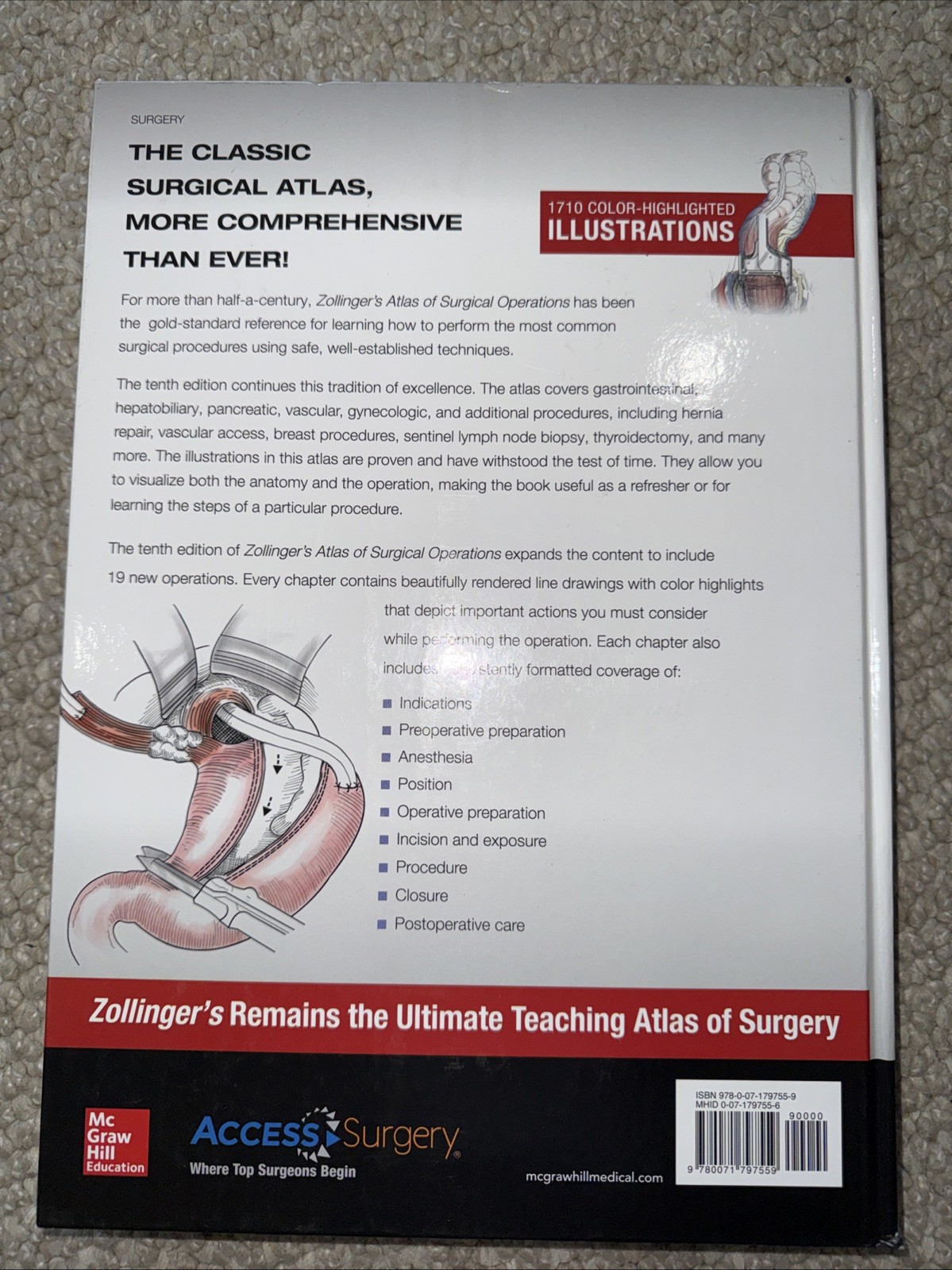 Zollinger’s Atlas of – Hardcover, by Zollinger Robert; Ellison – Very Good