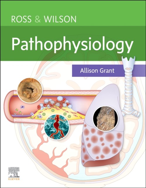 ROSS WILSON PATHOPHYSIOLOGY by Allison, BSc PhD RGN Department of Biological