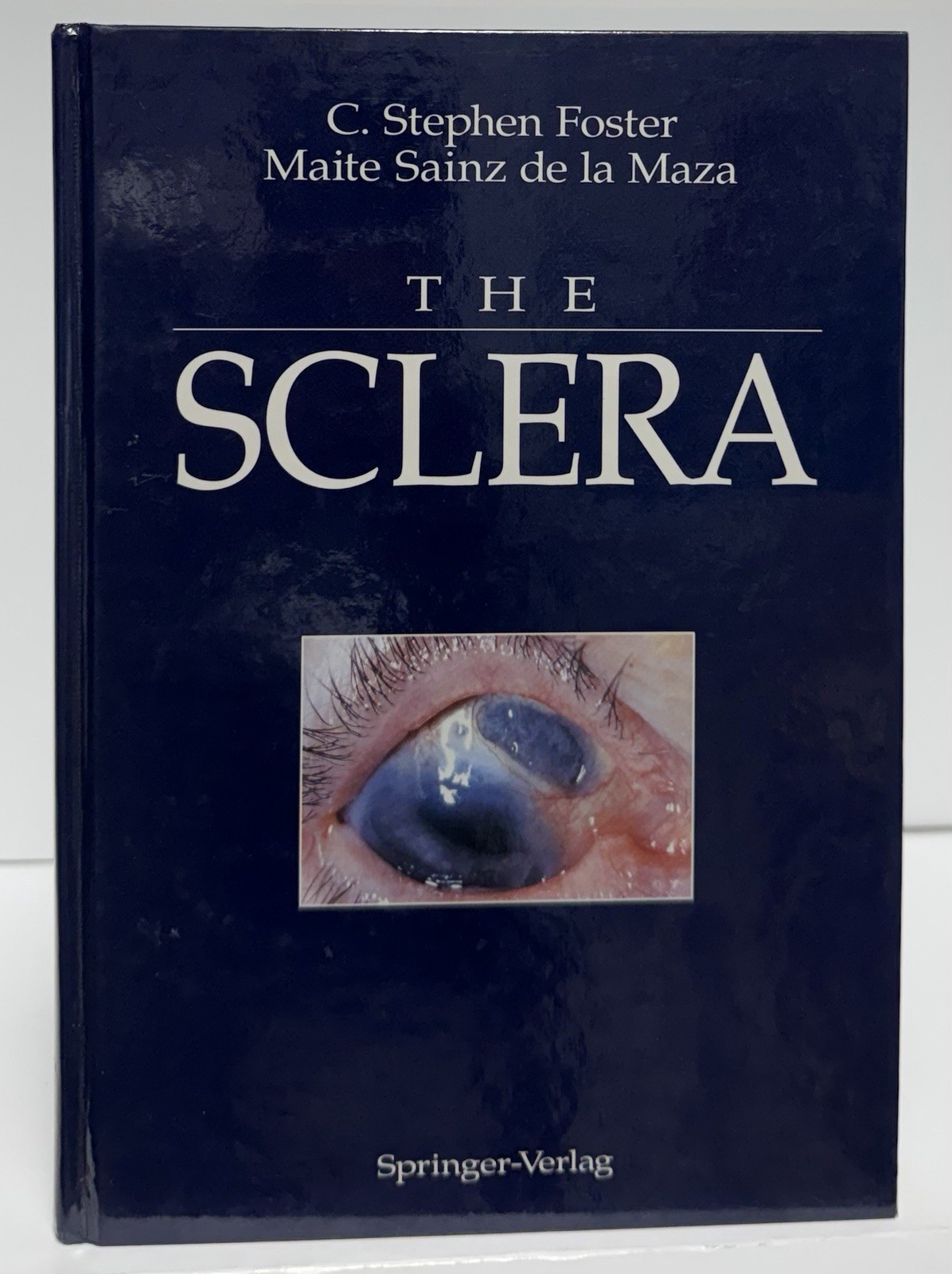 THE SCLERA By C. Stephen Foster & Sainz Maite De La Maza – [HARDCOVER]